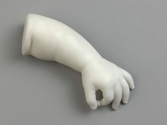Left arm and hand of Princess Louise