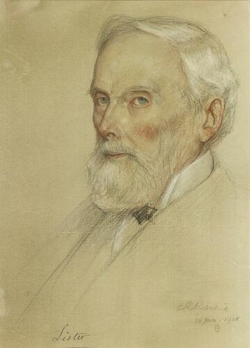 Joseph Lister, 1st Baron Lister, OM (1827-1912)