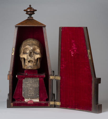 Skull of King Robert I (the Bruce)