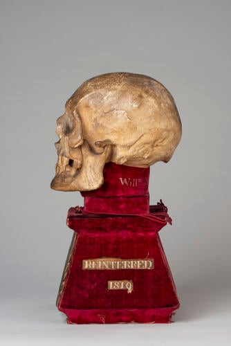Skull of King Robert I (the Bruce)
