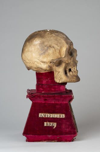 Skull of King Robert I (the Bruce)