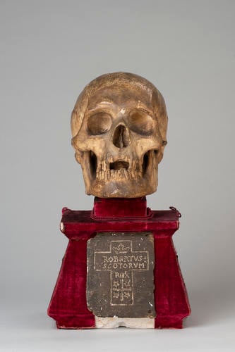 Skull of King Robert I (the Bruce)