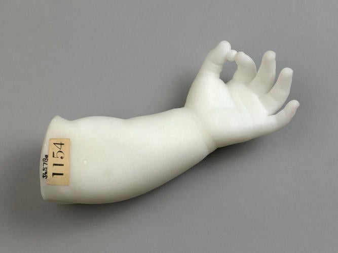 Left arm and hand of Princess Louise