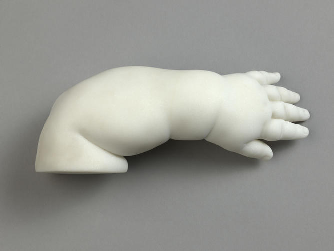 Arm and hand of Gaston d'Orleans, Comte d'Eu, aged 8 months, 1842