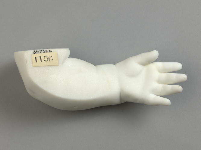 Arm and hand of Gaston d'Orleans, Comte d'Eu, aged 8 months, 1842